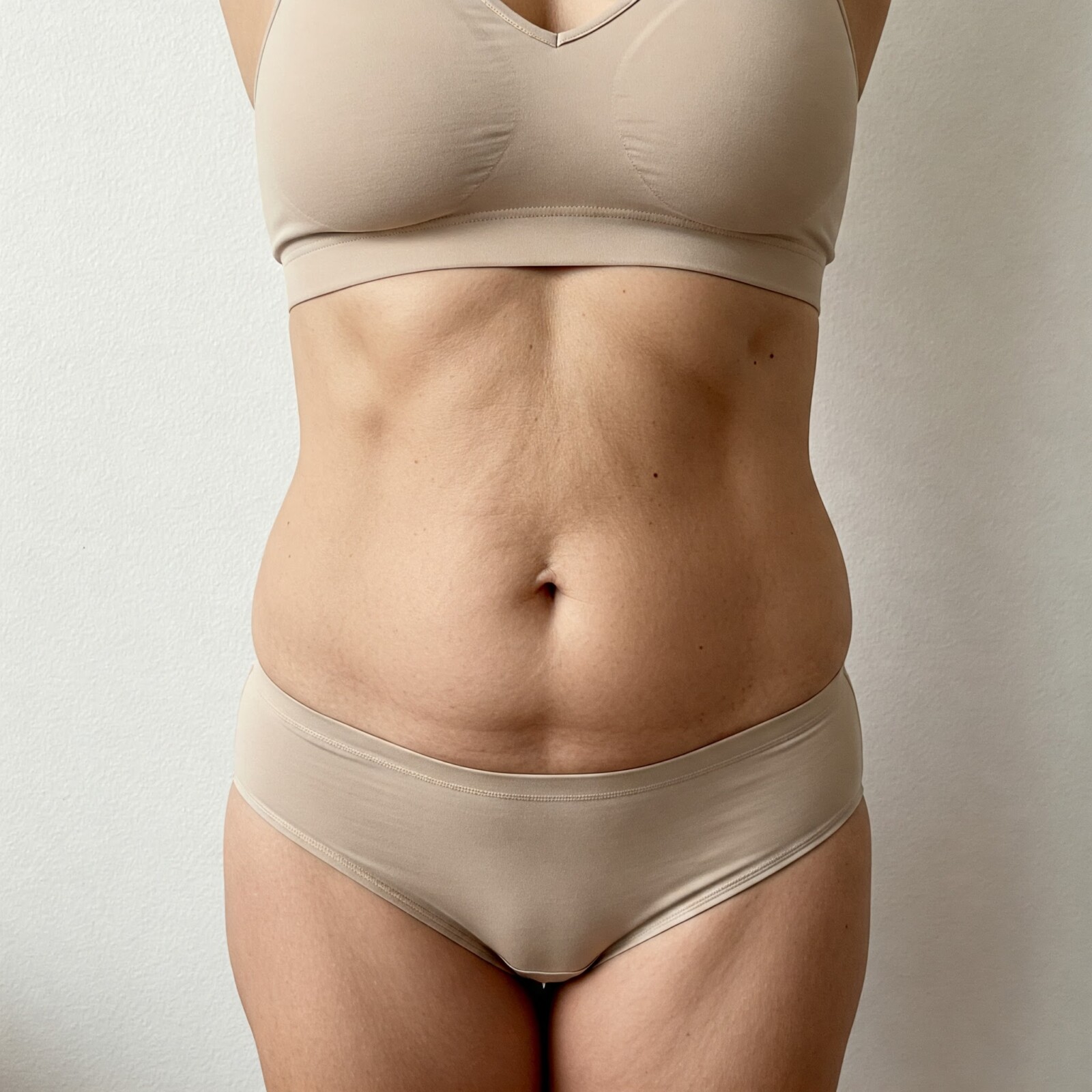 Cryo femme apres 2