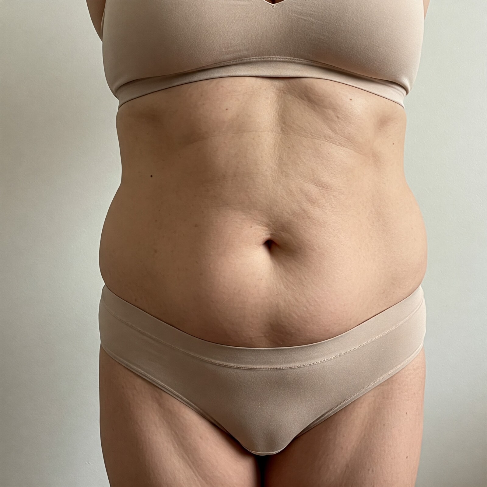 Cryo femme avant 2